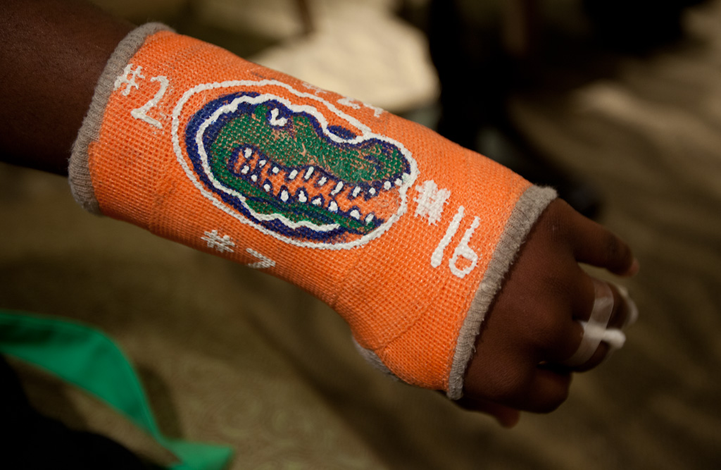 A Florida gator adorns the cast of a student who injured his fingers in football practice.